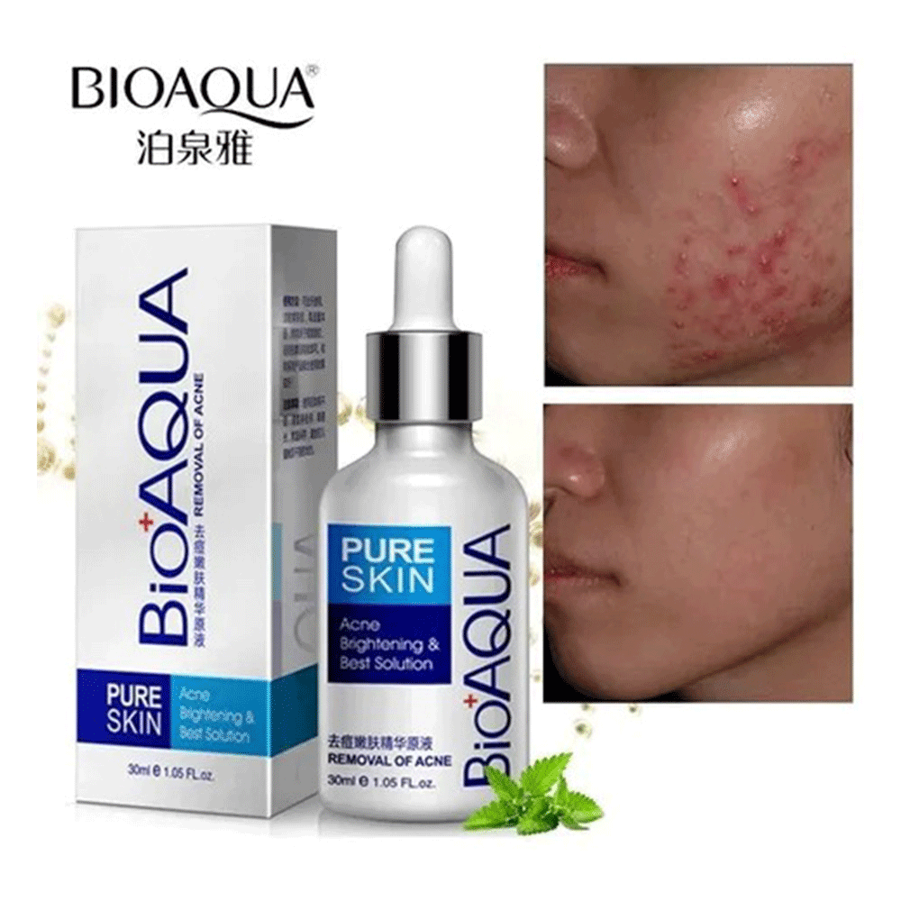 Sérum anti-acné BIOAQUA 30ml | Finesse Tunisie Sérum anti-acné BIOAQUA 30ml | Finesse Tunisie