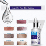 Sérum anti-acné BIOAQUA 30ml | Finesse Tunisie